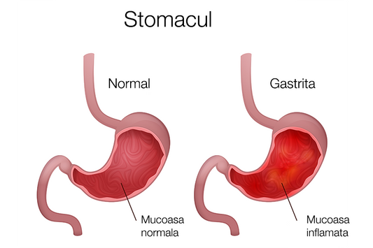 Afectiunile digestive